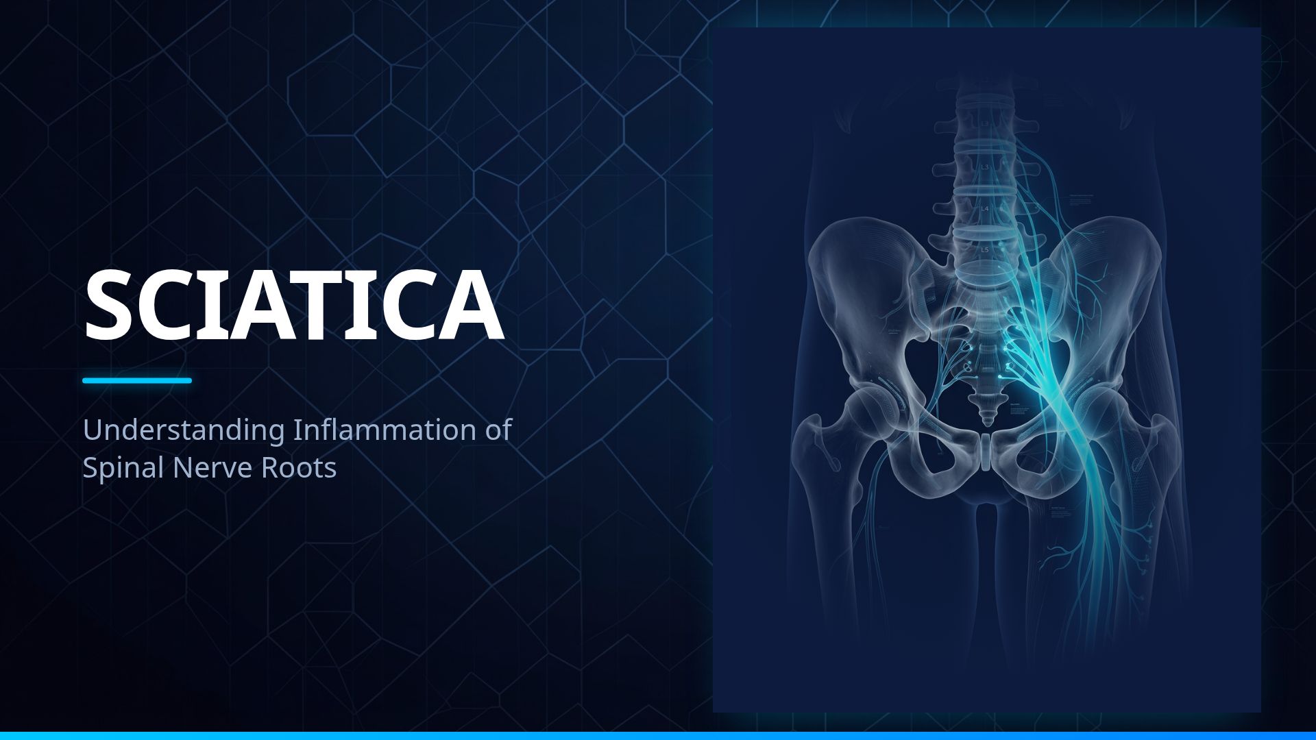 Sciatica: Causes, Symptoms, and Treatment Guide