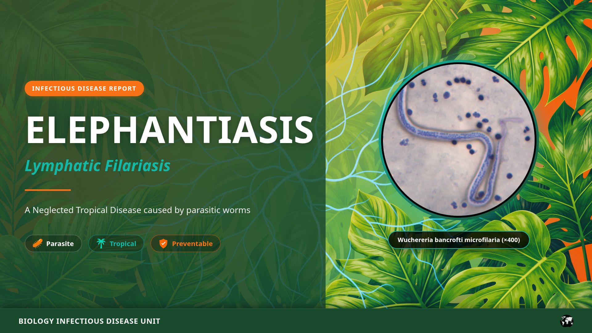 Understanding Elephantiasis: Lymphatic Filariasis Guide