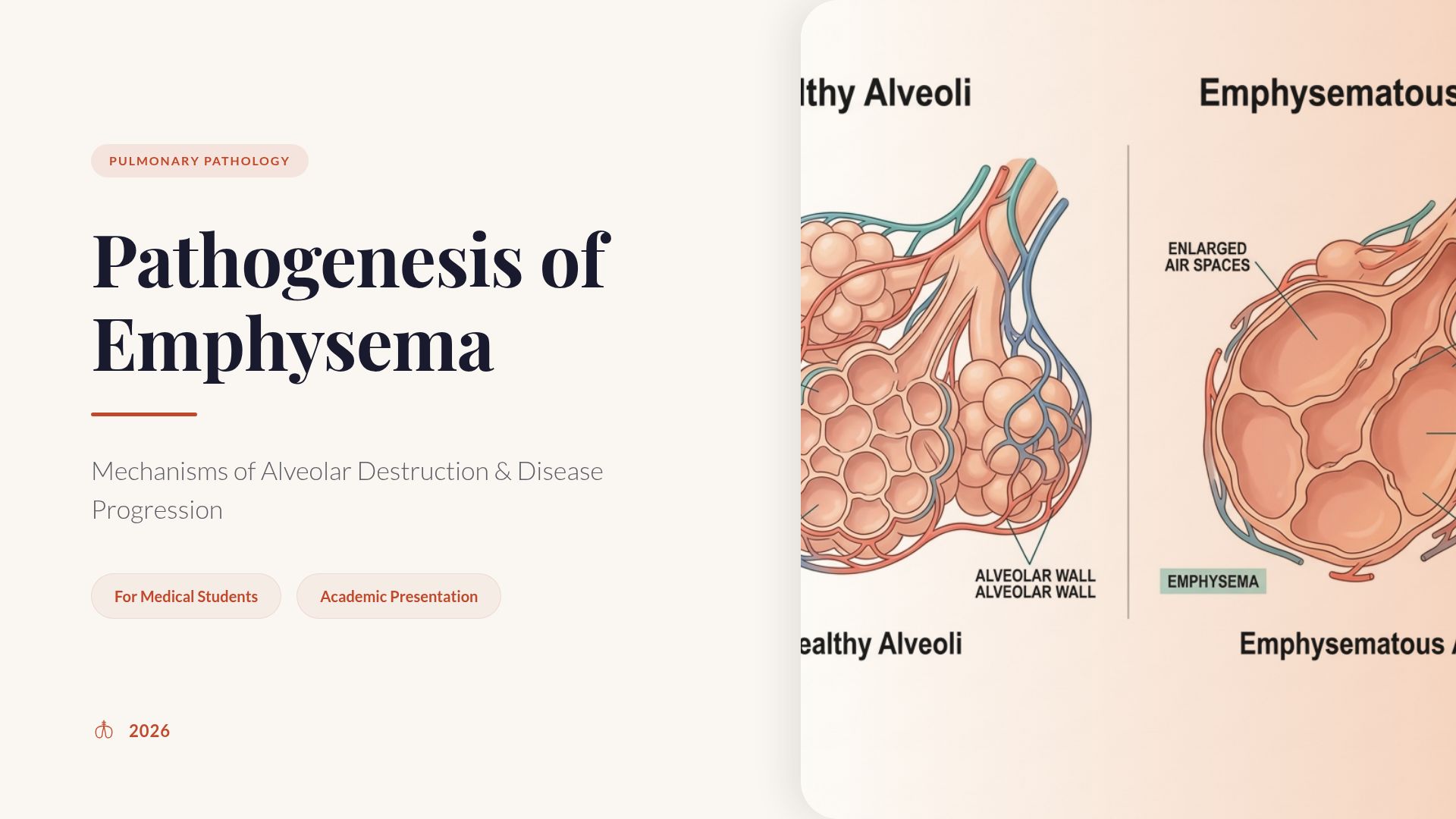 Pathogenesis of Emphysema: Alveolar Destruction Mechanisms