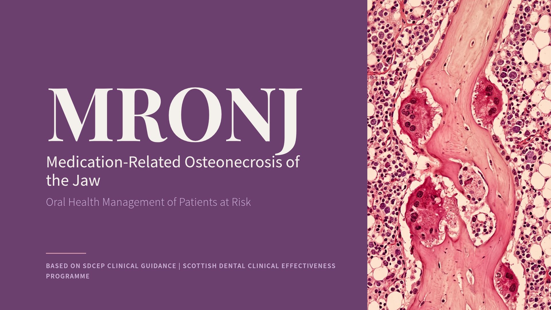 MRONJ Clinical Guidance for Dental Management