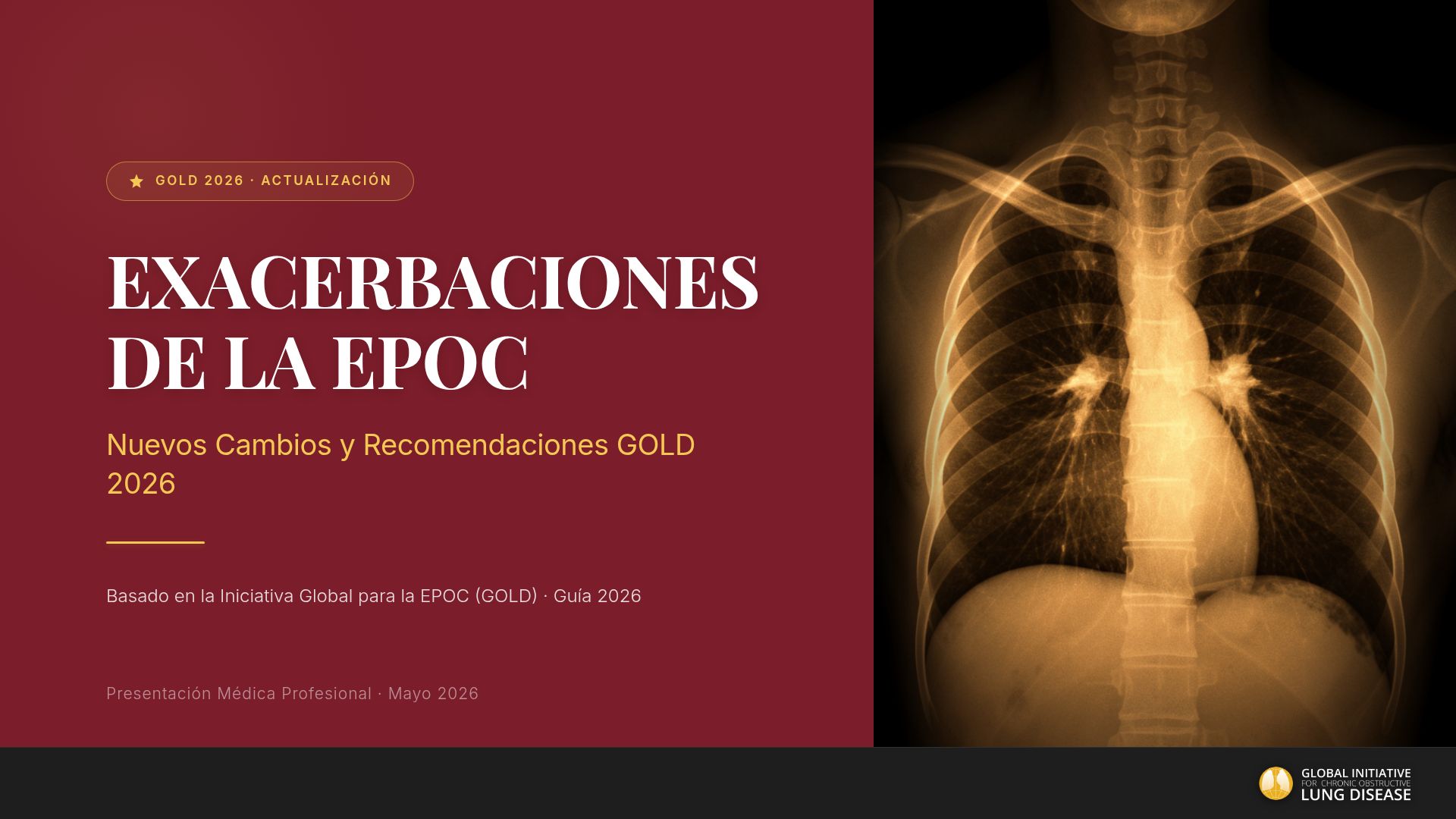 Guía GOLD 2026: Manejo de Exacerbaciones de la EPOC