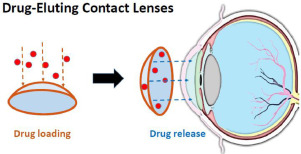Contact Lens Reference Diagram