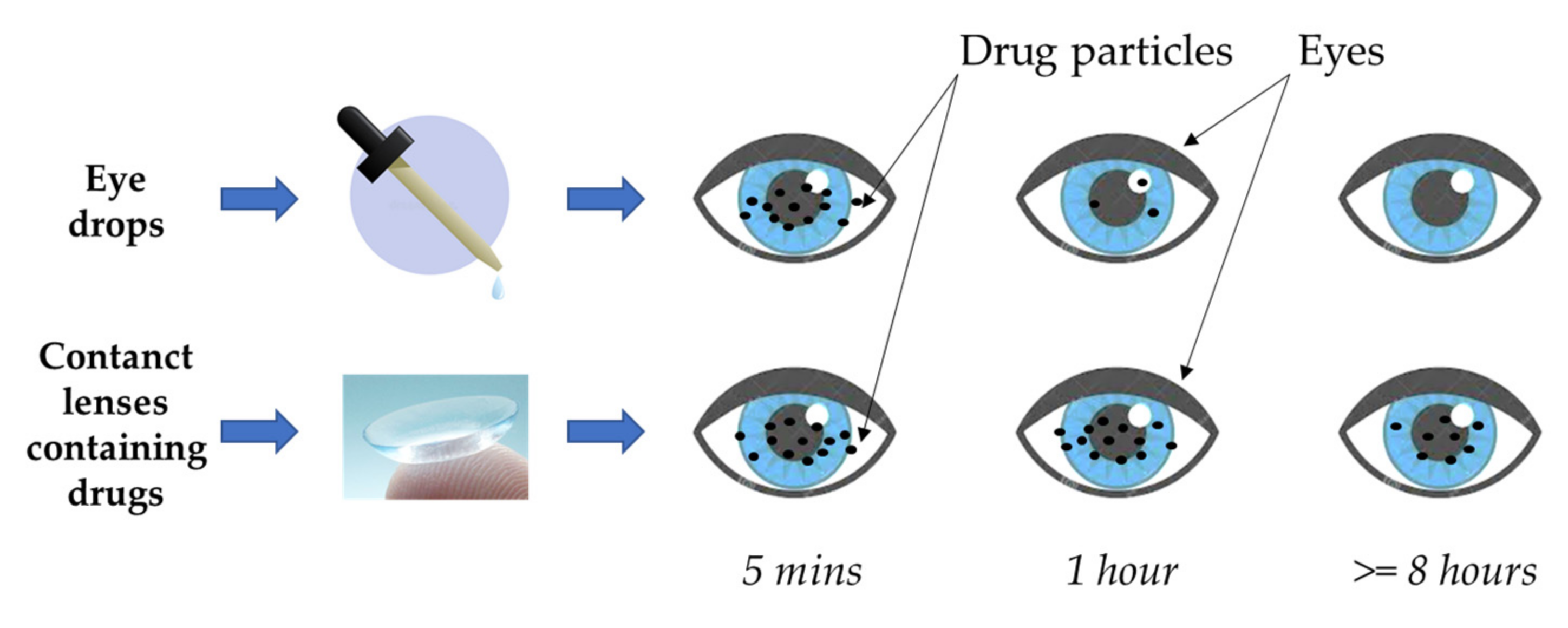 Contact Lens Configuration Diagram