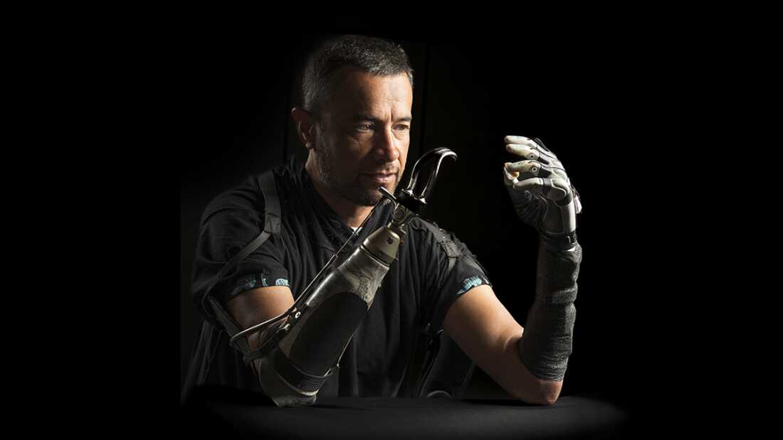 Prothèse robotique