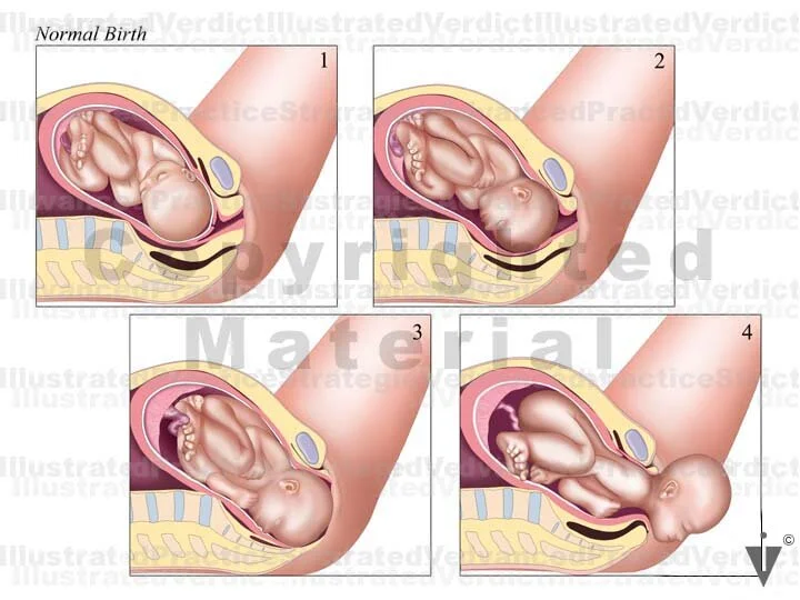 anatomical diagram showing fetal head applying pressure to cervix after amniotic sac rupture, medical illustration style